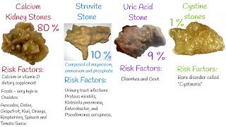 Kidney Stones  Types and Causes of Kidney Stones Symptoms and prevention [upl. by Vento]