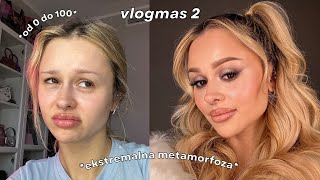 Potrzebuje glowupu 🌝 ekstremalny makeover💅🏻🎀 [upl. by Navaj219]