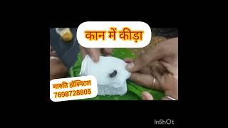 Live insect removal from earinsecttruptimarutihospital entsatisfyingendoscopyearcanal [upl. by Enar]