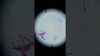 Acid fast bacilli in ZN stain [upl. by Zenia224]