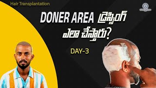 how to remove doner area  how to clean doner area  how to clean doner area in home without doctor [upl. by Arlee]