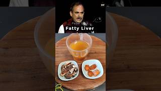 Manish Acharyas Best Home Remedy For Fatty Liver shorts [upl. by Asirap627]