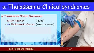 Lecture 251 Carriers alfa Thalassemia  Clinical Syndromes [upl. by Madid]