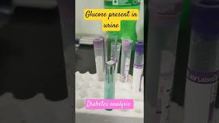 Diabetes analysis Diabetic patient  pathology  glucose in urine  test process ytshortindia [upl. by Naggem743]