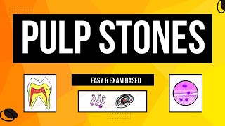 Denticles  Pulp Stones Classification  Age change in pulp [upl. by Tootsie]