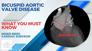 Why is Bicuspid Valve Disease Different [upl. by Ettevy]