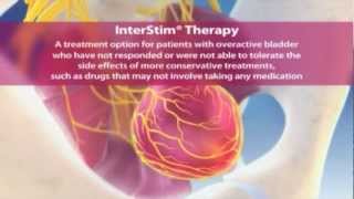 Interstim Therapy Animation [upl. by Sioled]