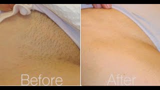 Brazilian Waxing 101 All You Need To knowTips [upl. by Irmo]