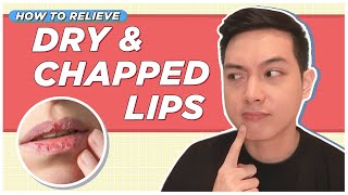 Best Ways to Relieve DRY amp CHAPPED LIPS Filipino  Jan Angelo [upl. by Casilde]