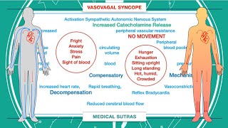 What is syncope and how to manage it [upl. by Odraboel]