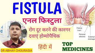 Homeopathic Medicine For Fistula in hindi  फिस्टुला की होम्योपैथिक दवा  भगंदर की होम्योपैथिक दवा [upl. by Martsen]