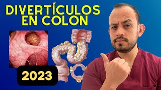 ¡CÁNCER de COLON SÍGNOS y SÍNTOMAS de ALERTA que NUNCA DEBES IGNORAR [upl. by Mcleroy]