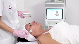 Galenpora microdermabrasion and electroporation for face and body [upl. by Honebein]