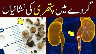 Gurday main Pathri ki Nishaniyan  Kidney Stones Symptoms [upl. by Novek]