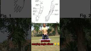 Carrying angle elbow problem sorts youtubeshorts carryinganglecarryingangleelbow youtube [upl. by Acnairb847]