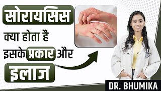 Psoriasis Symptoms Causes and Treatment  Psoriasis Treatment  Dr Bhumika [upl. by Meredi426]