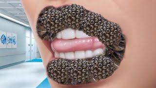 ASMR Animation Treatment Infected 🚑 Lips Treatment Collection Lips 🤧  Deep Cleaning Animation [upl. by Nednil]