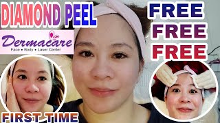 DIAMOND PEEL TREATMENT COMPLETE PROCEDURE FOR FREE [upl. by Bergquist]