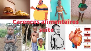 éducation nutritionnelle et hygiène de lappareil digestif 🔻 partie 4 carences alimentaires quotsuitequot [upl. by Nudd]