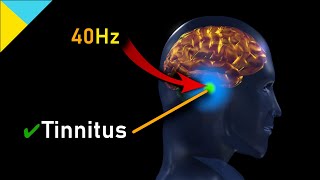 Tinnitus quotMIRACLEquot Quantum Healing Frequency HAS ARRIVED 40Hz • Gamma Waves [upl. by Shimberg]