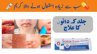 Betaderm N Cream uses in Urdu  Acne Cream Review [upl. by Anairdna]