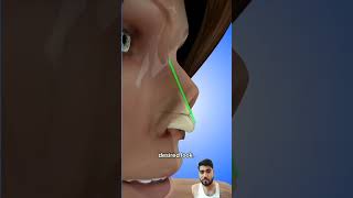 piercing beauty skincare satisfying nose nosejobs rhinoplastycost plasticsurgery rhinoplast [upl. by Avrenim]