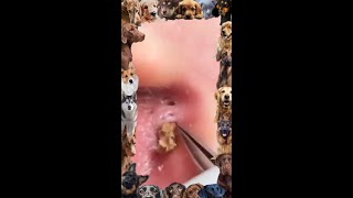 Blackhead removal video  06 Ear Blackhead extraction  blackheads [upl. by Seften]