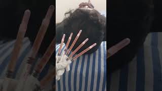 Hair PRP Treatment 👩🏻‍⚕️prp viralvideo youtubeshorts youtubevideos behindwoods galattadotcom [upl. by Yttam]