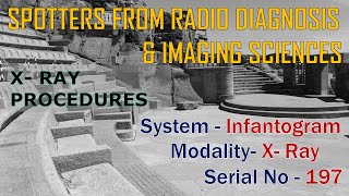 SPOTTERS FROM XRAY INFANTOGRAM SERIAL NO  197 BY DR  ANIL JOSHI PROFESSOR OF RADIOLOGY [upl. by Enairda]