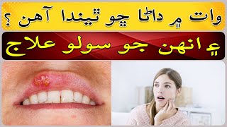 Why are there herpetic stomatitis in the mouth [upl. by Pirzada]