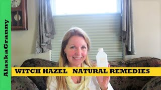 Witch Hazel Benefits Uses and Remedies [upl. by Ariella]