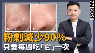 粉刺清不掉？痘痘一直長？吃『它』超有效，大幅降低粉刺發生率！【77老大】 [upl. by Grane263]