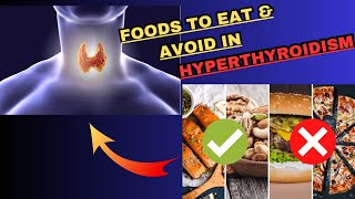 Hyperthyroidism Diet Plan  Hyperthyroidism Foods to Eat amp Foods to Avoid  Hyperthyroidism Symptoms [upl. by Nodnil]