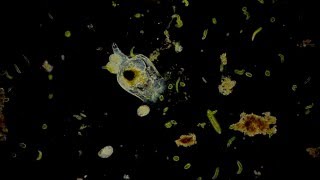 🔬 Rädertierchen  Rotifer  Dunkelfeld  life in a drop  dark field microscope microorganism [upl. by Vaientina]