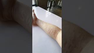 Have you heard of SKIN WRITING skinwriting dermatographia JJJreact [upl. by Ainosal]