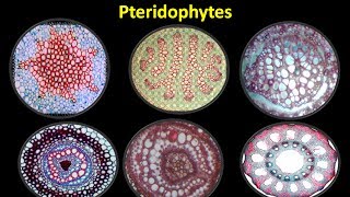 Types of Stele and its Evolution in Pteridophytes [upl. by Starks]