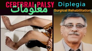 Spastic Cerbral Palsy Diplegia Detailed overview  Surgical and Rehabilitation Treatment Pathways [upl. by Kcor]