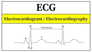 ECG Interpretation Made Easy  ECG Basics In Urdu  Electrocardiogram Of Heart In Hindi [upl. by Leanard]