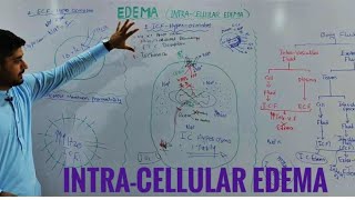 Intracellular edema pathophysiologyedema part 2 [upl. by Lanoil]