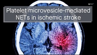 Platelet microvesiclemediated NET formation promotes thrombosis brain injury in ischemic stroke [upl. by Inavoig]