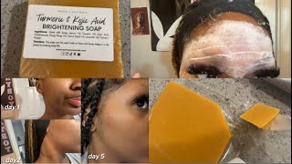 Turmeric amp Kojic Acid Soap From TikTok [upl. by Andrej]