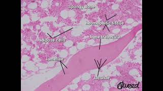 Spongy bone under light microscope [upl. by Ociredef]