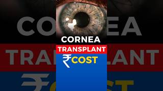 Cornea Transplant Cost [upl. by Akienom875]