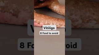 8 Foods to Avoid if You Have Vitiligo vitiligotreatment vitiligo vitiligofood [upl. by Maryl684]