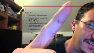 Nail Gun Put a Nail Through My Finger  33  My Garage Build HD Time Lapse [upl. by Lubbock237]