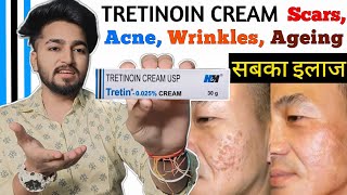 Tretinoin Cream Complete Information  Tretinoin Cream Benifits and Side Effects  Tretin Cream [upl. by Keily]