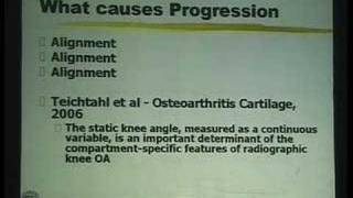 Lecture  High Tibial Osteotomy for Knee Arthritis  Part 1 [upl. by Isawk]