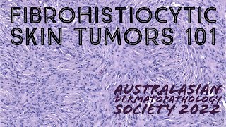 Fibrohistiocytic Skin Tumors 101 Australasian Dermatopathology Society 2022 meeting pathology [upl. by Riccardo]