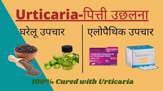 Urticariaपित्ती उछलना Allopathic treatments amp Home Remedies in Hindi II शीतपित्त का 100 इलाज I [upl. by Diahann847]