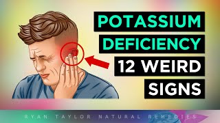 12 Strange Signs Your Body NEEDS Potassium [upl. by Eniaral348]